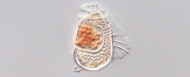 Strange Cellular Entity Challenges Very Definition of Life Itself